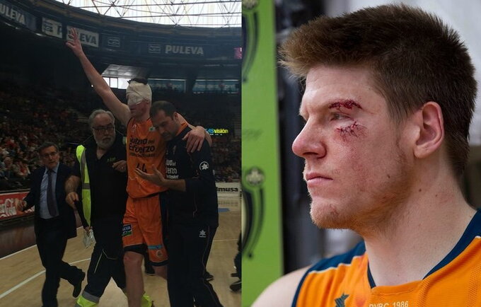 L.Harangody susidūrė su komandos draugu