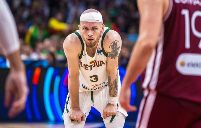 A.Veličkai buvo prakirsta galva (FIBA nuotr.)
